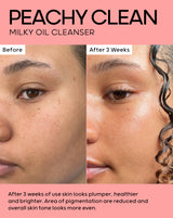 After 3 weeks of use skin looks plumper, healthier and brighter