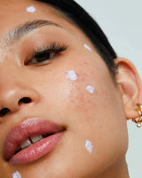 model applying Pure Clarity Targeted Blemish Paste