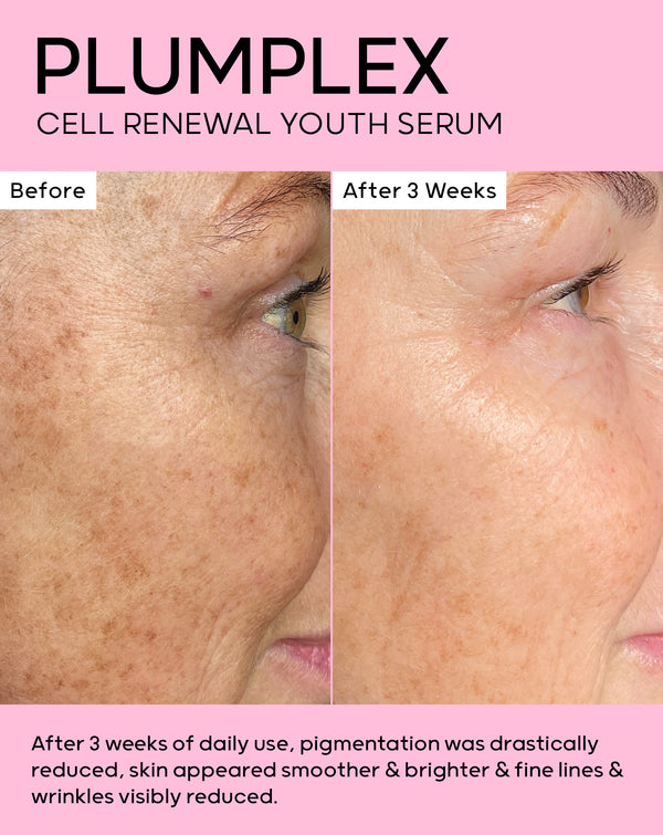After 3 weeks of daily use, skin appeared smoother & brighter, fine lines & wrinkles visibly reduced. 