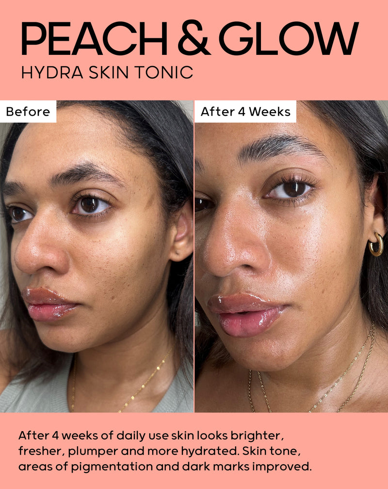 After 4 weeks of daily use skin looks brighter, fresher, plumper and more hydrated